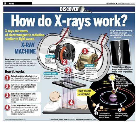 how many months does xray last|X.